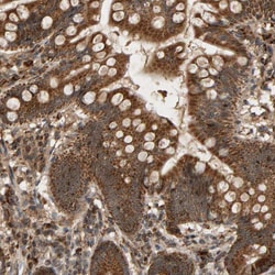 Invitrogen GSTK1 Polyclonal Antibody 100 &mu;L; Unconjugated:Antibodies,