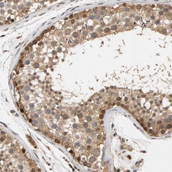 Invitrogen GSTK1 Polyclonal Antibody 100 &mu;L; Unconjugated:Antibodies,
