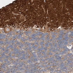 Invitrogen ARTS Polyclonal Antibody 100 &mu;L; Unconjugated:Antibodies,