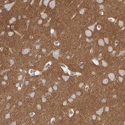 Invitrogen ARTS Polyclonal Antibody 100 &mu;L; Unconjugated:Antibodies,