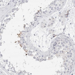 Invitrogen ARTS Polyclonal Antibody 100 &mu;L; Unconjugated:Antibodies,