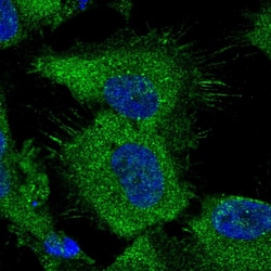 Invitrogen ATP Citrate Lyase Polyclonal Antibody 100 &mu;L; Unconjugated:Antibodies,