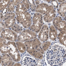 Invitrogen ATP Citrate Lyase Polyclonal Antibody 100 &mu;L; Unconjugated:Antibodies,