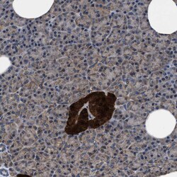 Invitrogen ATP Citrate Lyase Polyclonal Antibody 100 &mu;L; Unconjugated:Antibodies,