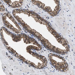 Invitrogen ATP Citrate Lyase Polyclonal Antibody 100 &mu;L; Unconjugated:Antibodies,