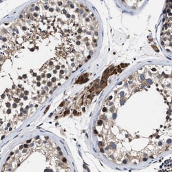 Invitrogen ATP Citrate Lyase Polyclonal Antibody 100 &mu;L; Unconjugated:Antibodies,