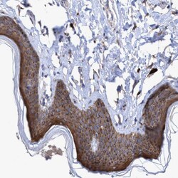 Invitrogen BICD2 Polyclonal Antibody 100 &mu;L; Unconjugated:Antibodies,