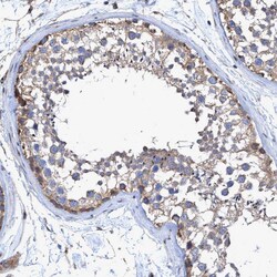 Invitrogen BICD2 Polyclonal Antibody 100 &mu;L; Unconjugated:Antibodies,