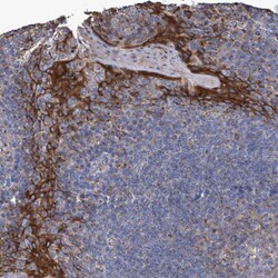 Invitrogen BICD2 Polyclonal Antibody 100 &mu;L; Unconjugated:Antibodies,