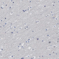 Invitrogen IDO Polyclonal Antibody 100 &mu;L; Unconjugated:Antibodies,
