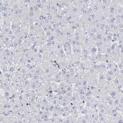 Invitrogen CBX2 Polyclonal Antibody 100 &mu;L | Buy Online | Invitrogen&trade; | Fisher Scientific