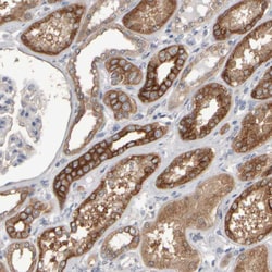 Invitrogen EPHX2 Polyclonal Antibody 100 &mu;L; Unconjugated:Antibodies,