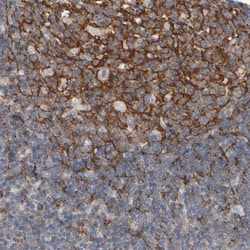 Invitrogen EPHX2 Polyclonal Antibody 100 &mu;L; Unconjugated:Antibodies,