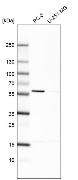 Invitrogen EPHX2 Polyclonal Antibody 100 &mu;L | Buy Online | Invitrogen&trade; | Fisher Scientific
