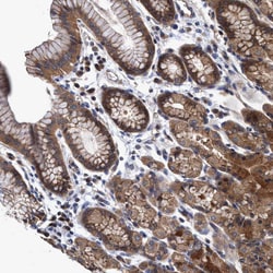 Invitrogen CALCOCO2 Polyclonal Antibody 100 &mu;L; Unconjugated:Antibodies,