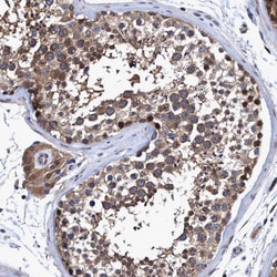 Invitrogen CALCOCO2 Polyclonal Antibody 100 &mu;L; Unconjugated:Antibodies,