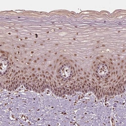 Invitrogen BRD9 Polyclonal Antibody 100 &mu;L; Unconjugated:Antibodies,