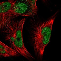 Invitrogen MSK2 Polyclonal Antibody 100 &mu;L; Unconjugated:Antibodies,