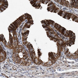 Invitrogen C8orf55 Polyclonal Antibody 100 &mu;L; Unconjugated:Antibodies,