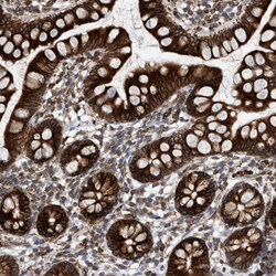 Invitrogen C8orf55 Polyclonal Antibody 100 &mu;L; Unconjugated:Antibodies,