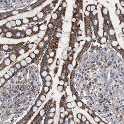 Invitrogen CRYZ Polyclonal Antibody 100 &mu;L; Unconjugated:Antibodies,