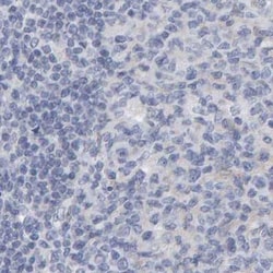Invitrogen CTH Polyclonal Antibody 100 &mu;L; Unconjugated:Antibodies,