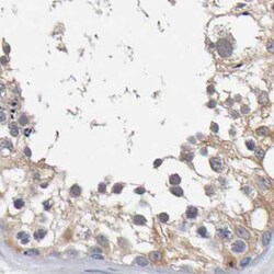 Invitrogen CTH Polyclonal Antibody 100 &mu;L; Unconjugated:Antibodies,