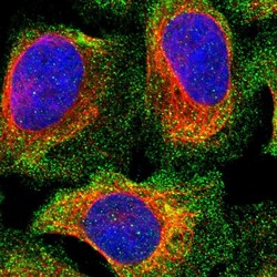 Invitrogen PPP3CC Polyclonal Antibody 100 &mu;L; Unconjugated:Antibodies,