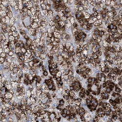 Invitrogen SGSH Polyclonal Antibody 100 &mu;L; Unconjugated:Antibodies,