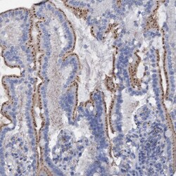 Invitrogen SGSH Polyclonal Antibody 100 &mu;L; Unconjugated:Antibodies,