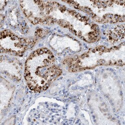 Invitrogen SGSH Polyclonal Antibody 100 &mu;L; Unconjugated:Antibodies,
