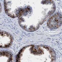 Invitrogen SGSH Polyclonal Antibody 100 &mu;L; Unconjugated:Antibodies,