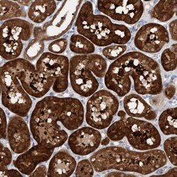 Invitrogen ENC-2 Polyclonal Antibody 100 &mu;L; Unconjugated:Antibodies,