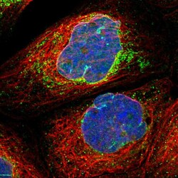 Invitrogen MRPS23 Polyclonal Antibody 100 &mu;L; Unconjugated:Antibodies,