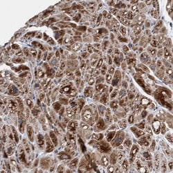 Invitrogen MRPS23 Polyclonal Antibody 100 &mu;L; Unconjugated:Antibodies,
