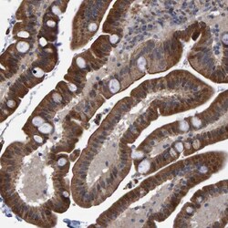 Invitrogen TRIM68 Polyclonal Antibody 100 &mu;L; Unconjugated:Antibodies,