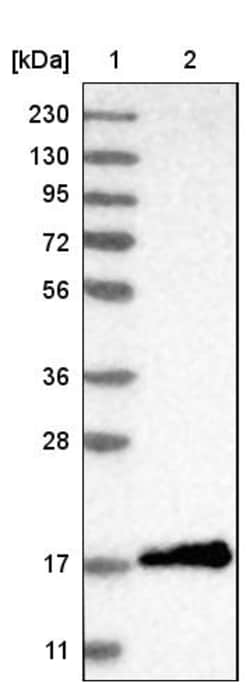 Invitrogen 4EBP1 Polyclonal Antibody 100 &mu;L; Unconjugated:Antikörper