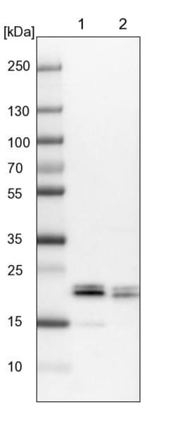Invitrogen 4EBP1 Polyclonal Antibody 100 &mu;L; Unconjugated:Antikörper