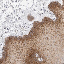 Invitrogen ZNF23 Polyclonal Antibody 100 &mu;L; Unconjugated:Antibodies,