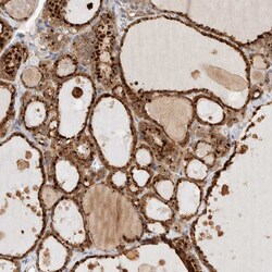 Invitrogen GCLM Polyclonal Antibody 100 &mu;L; Unconjugated:Antibodies,