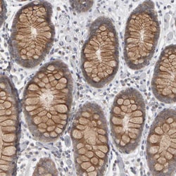 Invitrogen MSRA Polyclonal Antibody 100 &mu;L; Unconjugated:Antibodies,