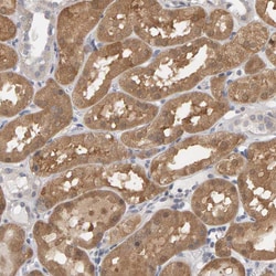 Invitrogen MSRA Polyclonal Antibody 100 &mu;L; Unconjugated:Antibodies,