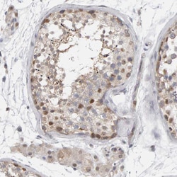Invitrogen MSRA Polyclonal Antibody 100 &mu;L; Unconjugated:Antibodies,