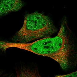 Invitrogen DMTF1 Polyclonal Antibody 100 &mu;L; Unconjugated:Antibodies,