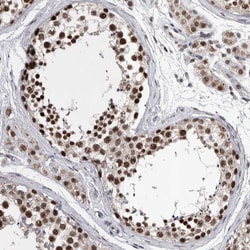 Invitrogen DMTF1 Polyclonal Antibody 100 &mu;L; Unconjugated:Antibodies,