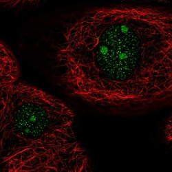 Invitrogen ARID5A Polyclonal Antibody 100 &mu;L; Unconjugated:Antibodies,