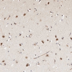 Invitrogen ARID5A Polyclonal Antibody 100 &mu;L; Unconjugated:Antibodies,