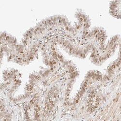 Invitrogen ARID5A Polyclonal Antibody 100 &mu;L; Unconjugated:Antibodies,