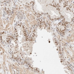 Invitrogen ARID5A Polyclonal Antibody 100 &mu;L; Unconjugated:Antibodies,
