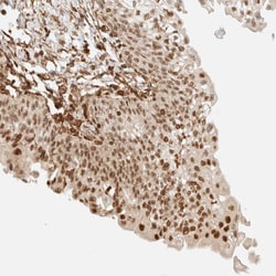 Invitrogen ARID5A Polyclonal Antibody 100 &mu;L; Unconjugated:Antibodies,